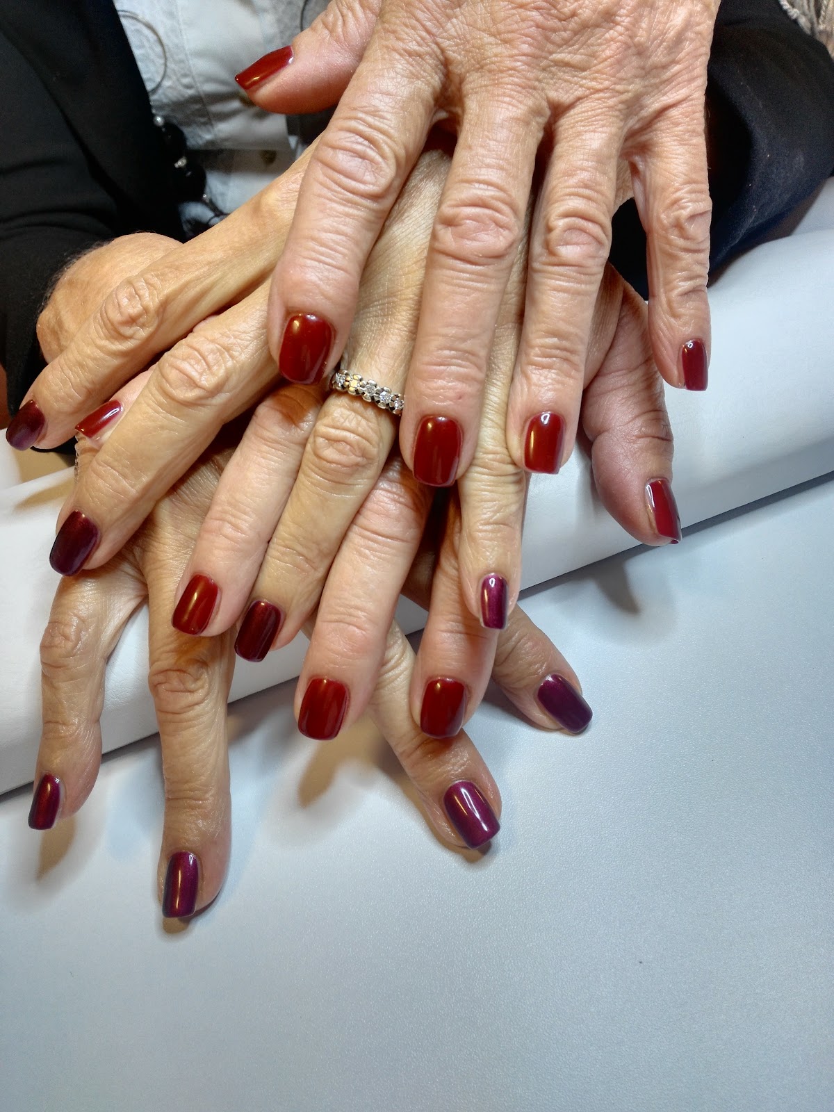 Ricostruzione acrilico